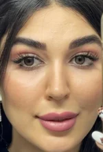 لنز طبی و رنگی نچرال کاپوچینو(قهوه ای عسلی)