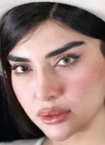 لنز کورهیزل(عسلی بدون دور) - تصویر 2